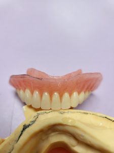 Reline and Rebase
